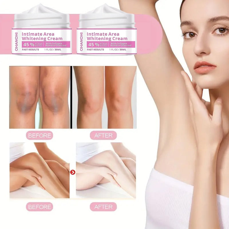 Whitening Cream for Men & Women Skin Brightening, Moisturizing & Dark Spot Removal Face & Body Lightening Cream for Underarms, Knees, Elbows & Private Areas
