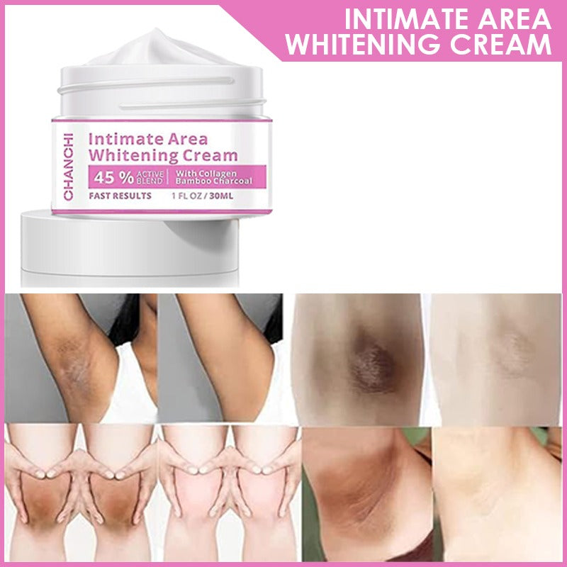 Whitening Cream for Men & Women Skin Brightening, Moisturizing & Dark Spot Removal Face & Body Lightening Cream for Underarms, Knees, Elbows & Private Areas