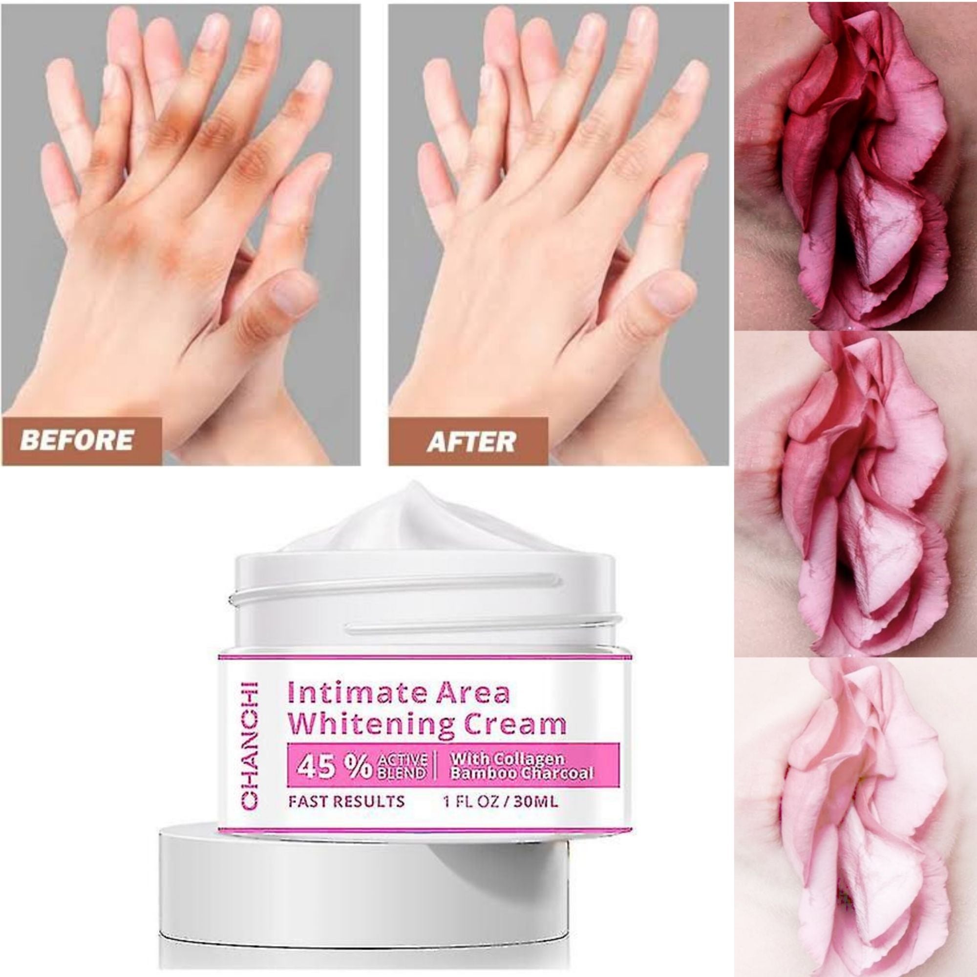 Whitening Cream for Men & Women Skin Brightening, Moisturizing & Dark Spot Removal Face & Body Lightening Cream for Underarms, Knees, Elbows & Private Areas